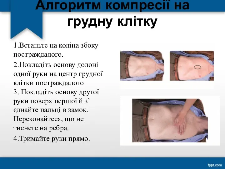 Алгоритм компресії на грудну клітку 1.Встаньте на коліна збоку постраждалого.