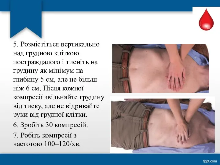 5. Розмістіться вертикально над грудною кліткою постраждалого і тисніть на