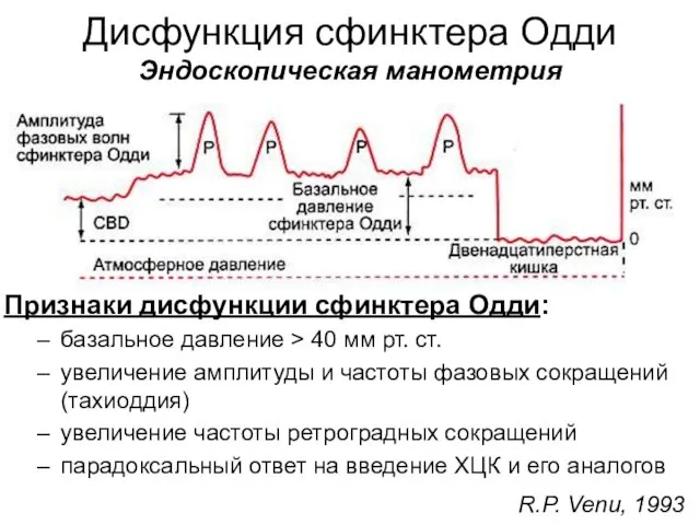 Дисфункция сфинктера Одди Эндоскопическая манометрия Признаки дисфункции сфинктера Одди: базальное