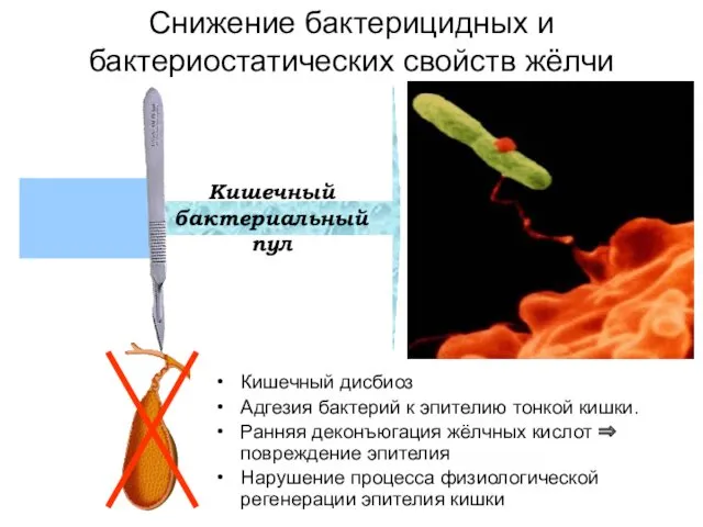 Снижение бактерицидных и бактериостатических свойств жёлчи Кишечный дисбиоз Адгезия бактерий