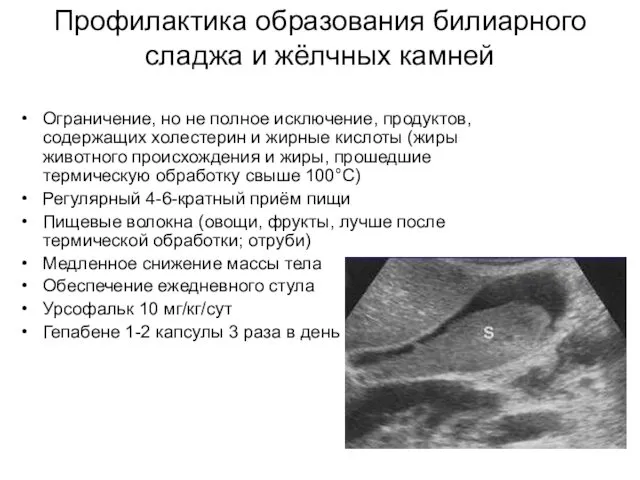 Профилактика образования билиарного сладжа и жёлчных камней Ограничение, но не