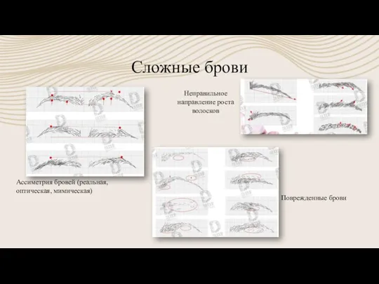 Сложные брови Поврежденные брови Ассиметрия бровей (реальная, оптическая, мимическая) Неправильное направление роста волосков