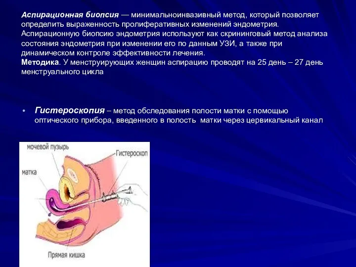 Аспирационная биопсия — минимальноинвазивный метод, который позволяет определить выраженность пролиферативных