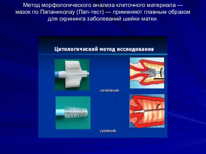 Метод морфологического анализа клеточного материала — мазок по Папаниколау (Пап-тест)