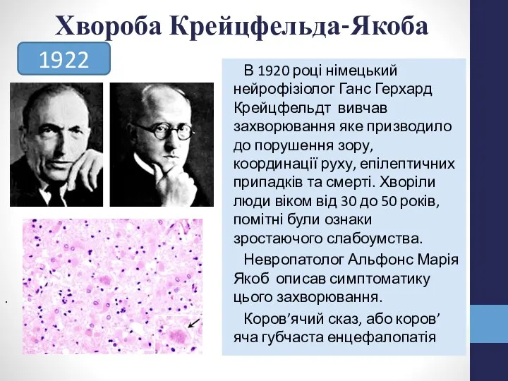 Хвороба Крейцфельда-Якоба В 1920 році німецький нейрофізіолог Ганс Герхард Крейцфельдт