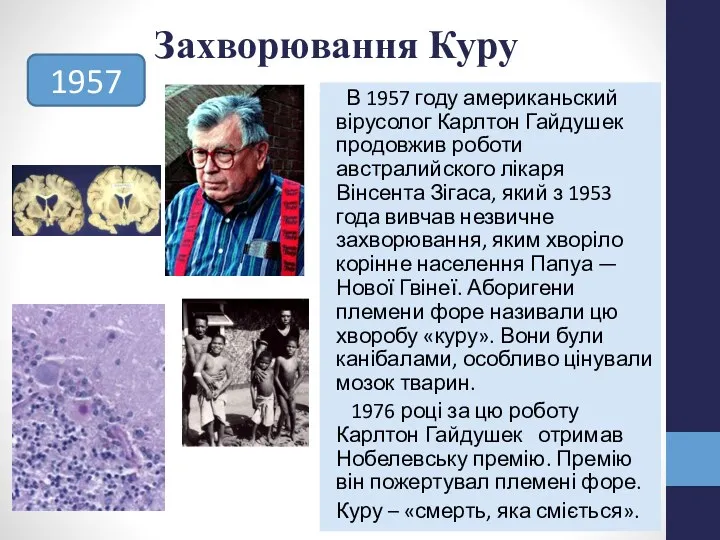 Захворювання Куру В 1957 году американьский вірусолог Карлтон Гайдушек продовжив