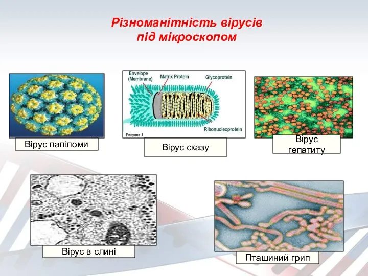 Різноманітність вірусів під мікроскопом Вірус папіломи Вірус сказу Вірус в слині Пташиний грип Вірус гепатиту