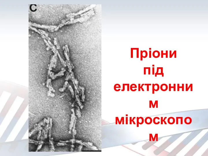 Пріони під електронним мікроскопом