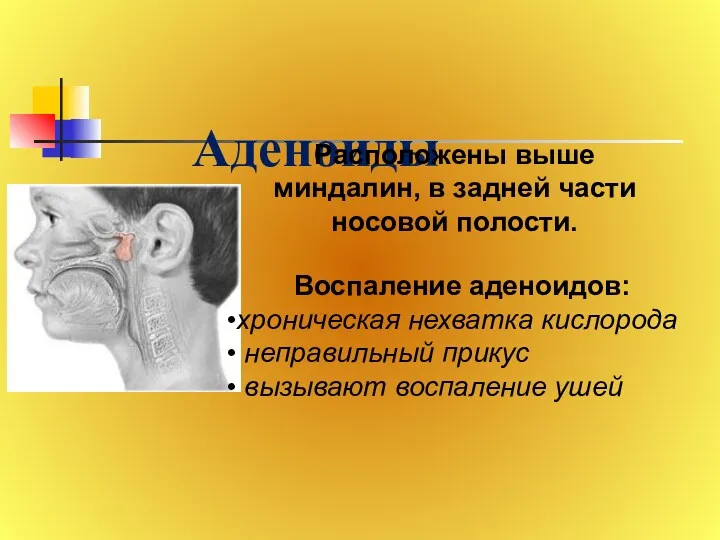 Аденоиды Расположены выше миндалин, в задней части носовой полости. Воспаление