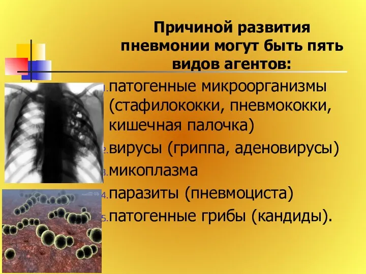 Причиной развития пневмонии могут быть пять видов агентов: патогенные микроорганизмы