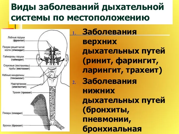 Виды заболеваний дыхательной системы по местоположению Заболевания верхних дыхательных путей