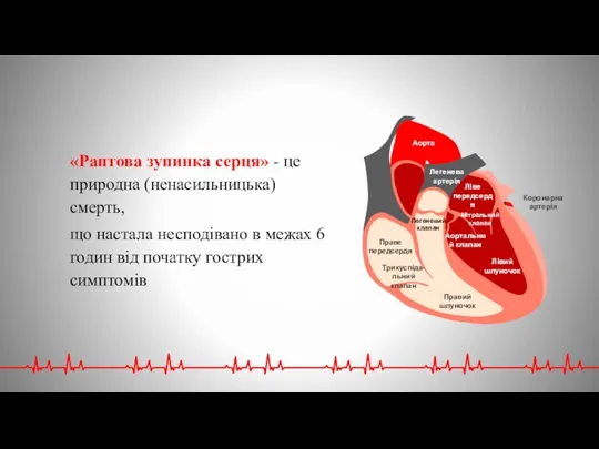 «Раптова зупинка серця» - це природна (ненасильницька) смерть, що настала