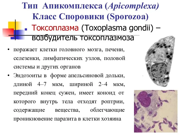 Тип Апикомплекса (Аpicomplexa) Класс Споровики (Sporozoa) Токсоплазма (Toxoplasma gondii) –