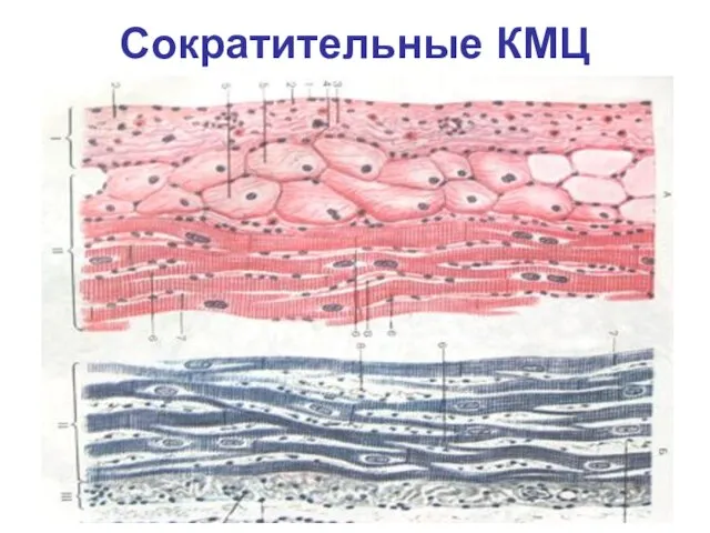 Сократительные КМЦ