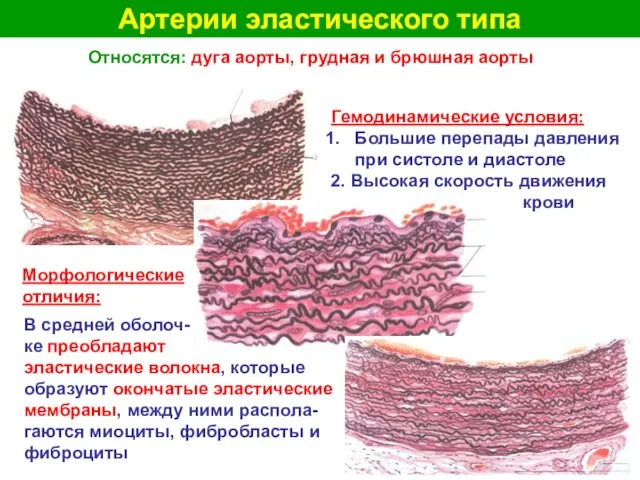 Артерии эластического типа Относятся: дуга аорты, грудная и брюшная аорты