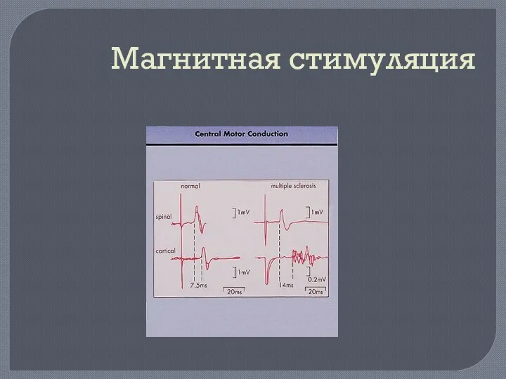 Магнитная стимуляция