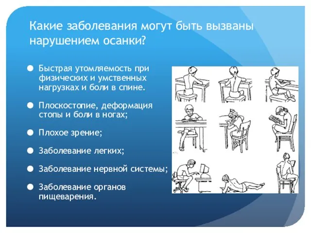 Какие заболевания могут быть вызваны нарушением осанки? Быстрая утомляемость при