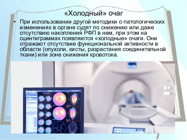 «Холодный» очаг При использовании другой методики о патологических изменениях в