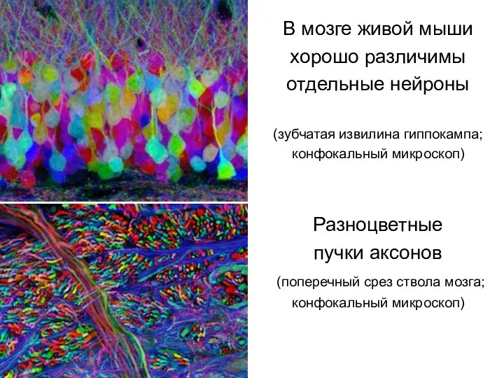 В мозге живой мыши хорошо различимы отдельные нейроны (зубчатая извилина гиппокампа; конфокальный микроскоп)