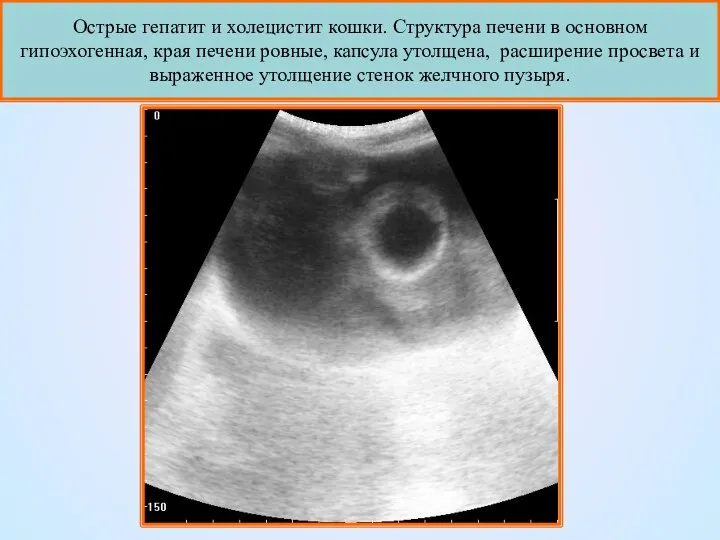 Острые гепатит и холецистит кошки. Структура печени в основном гипоэхогенная,