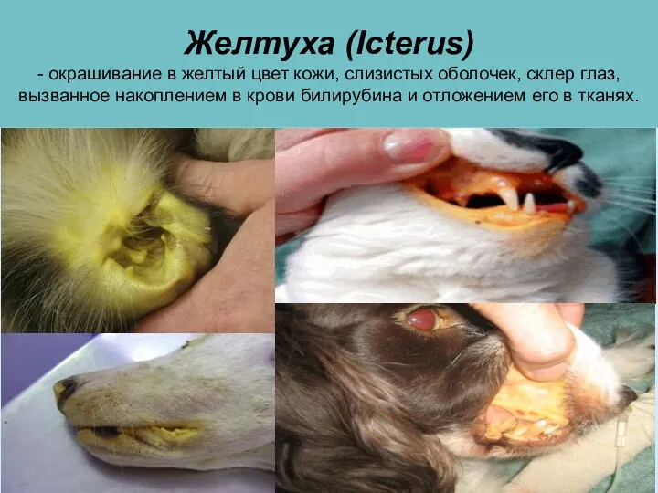 Желтуха (Icterus) - окрашивание в желтый цвет кожи, слизистых оболочек,