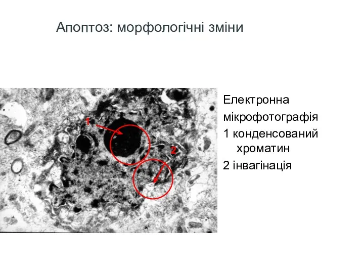 Апоптоз: морфологічні зміни Електронна мікрофотографія 1 конденсований хроматин 2 інвагінація 2 1