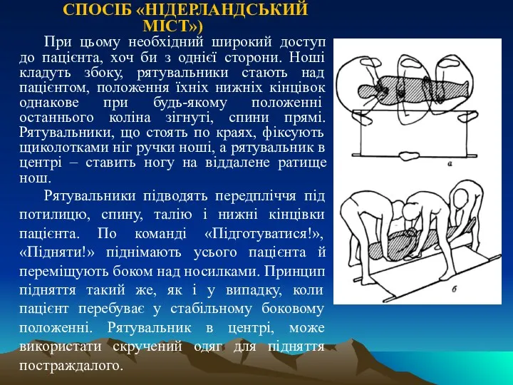 СПОСІБ «НІДЕРЛАНДСЬКИЙ МІСТ») При цьому необхідний широкий доступ до пацієнта,