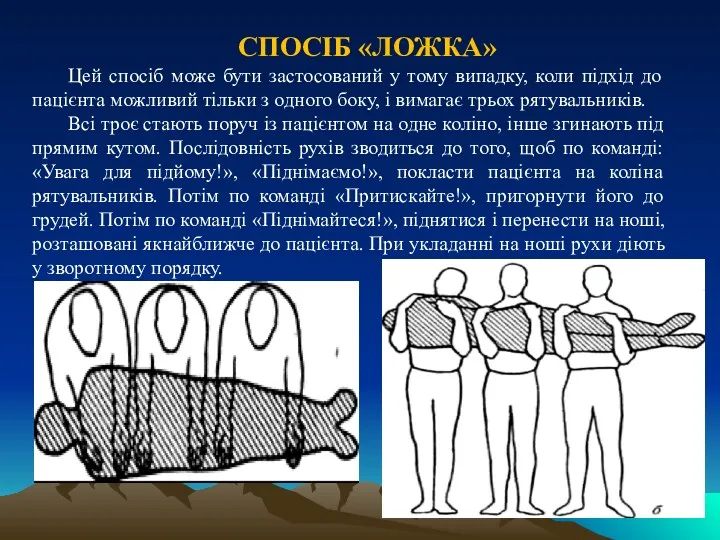 СПОСІБ «ЛОЖКА» Цей спосіб може бути застосований у тому випадку,