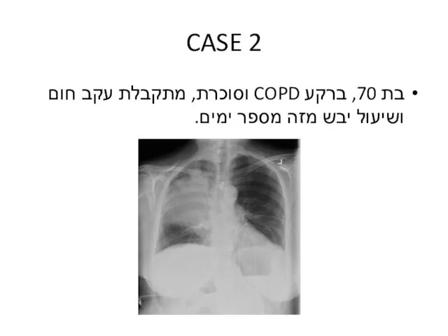 CASE 2 בת 70, ברקע COPD וסוכרת, מתקבלת עקב חום ושיעול יבש מזה מספר ימים.