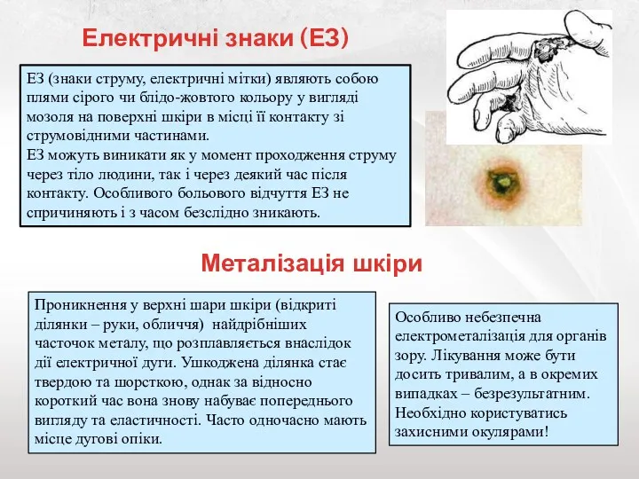 Електричні знаки (ЕЗ) ЕЗ (знаки струму, електричні мітки) являють собою