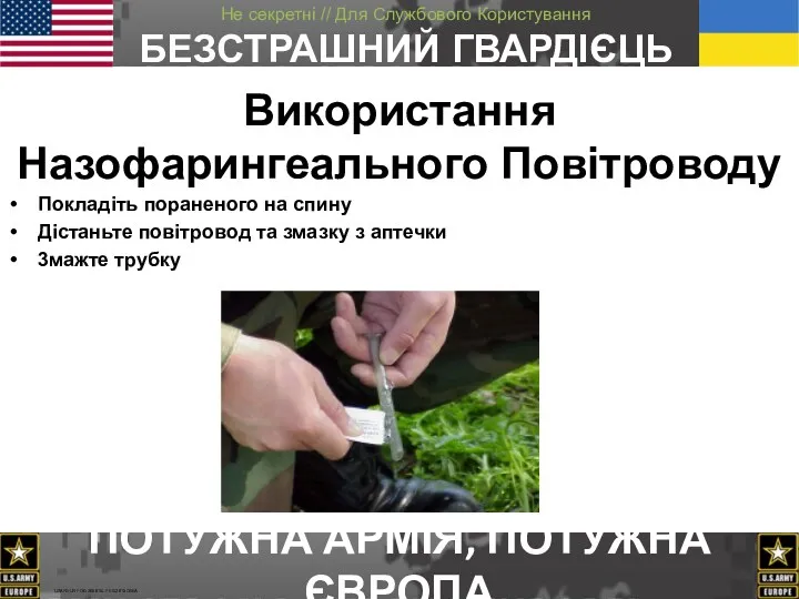 Використання Hазофарингеального Повітроводу Покладіть пораненого на спину Дістаньте повітровод та змазку з аптечки 3мажте трубку