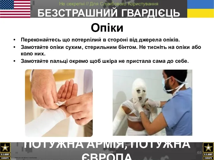 Опіки Переконайтесь що потерпілий в стороні від джерела опіків. Замотайте