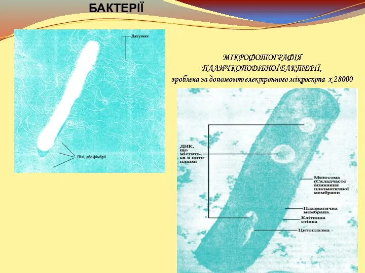 МІКРОФОТОГРАФІЯ ЗРІЗУ ТИПОВОЇ ПАЛИЧКОПОДІБНОЇ БАКТЕРІЇ