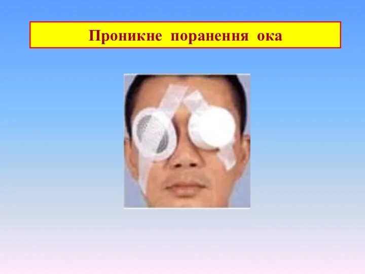 Проникне поранення ока