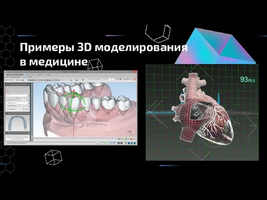 Примеры 3D моделирования в медицине