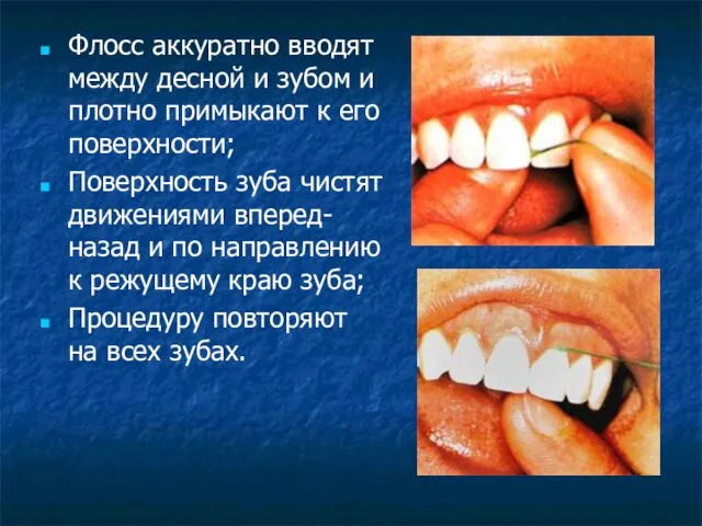 Флосс аккуратно вводят между десной и зубом и плотно примыкают
