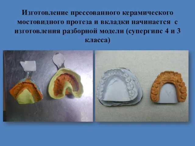 Изготовление прессованного керамического мостовидного протеза и вкладки начинается с изготовления