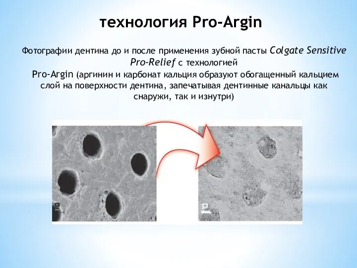 технология Pro-Argin Фотографии дентина до и после применения зубной пасты