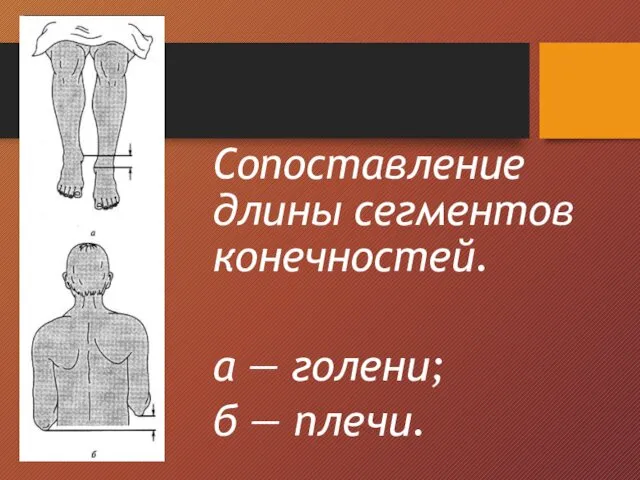 Сопоставление длины сегментов конечностей. а — голени; б — плечи.