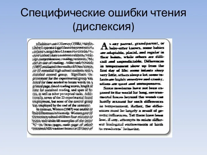 Специфические ошибки чтения (дислексия)