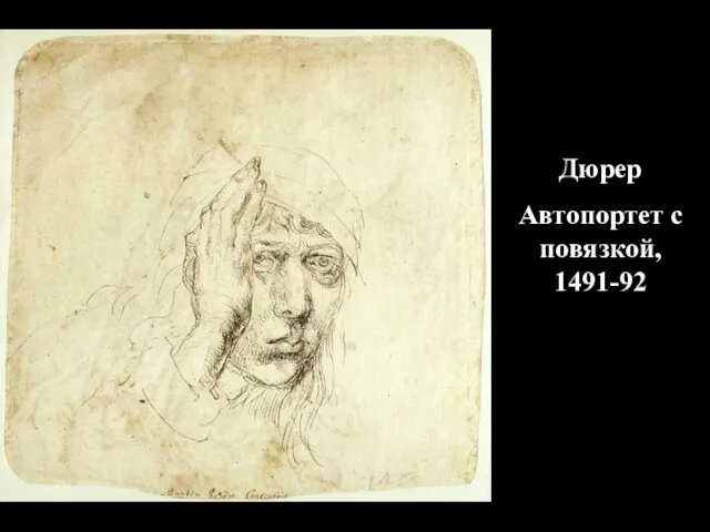 Дюрер Автопортет с повязкой, 1491-92