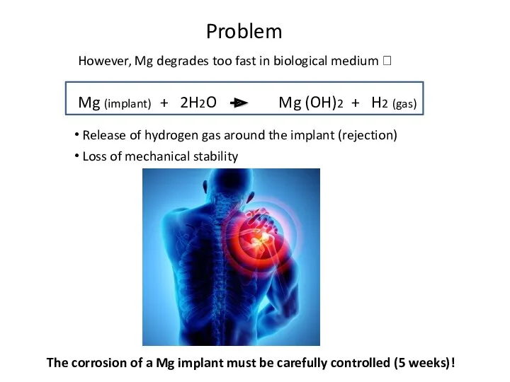 Problem However, Mg degrades too fast in biological medium ?