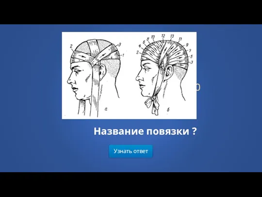 Узнать ответ Категория 5 / Вопрос за 200 Название повязки ?