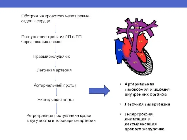 Обструкция кровотоку через левые отделы сердца Поступление крови из ЛП в ПП через
