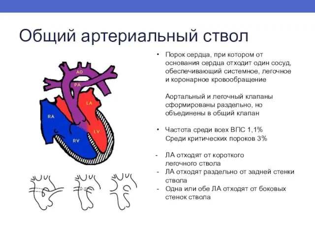 Общий артериальный ствол Порок сердца, при котором от основания сердца отходит один сосуд,