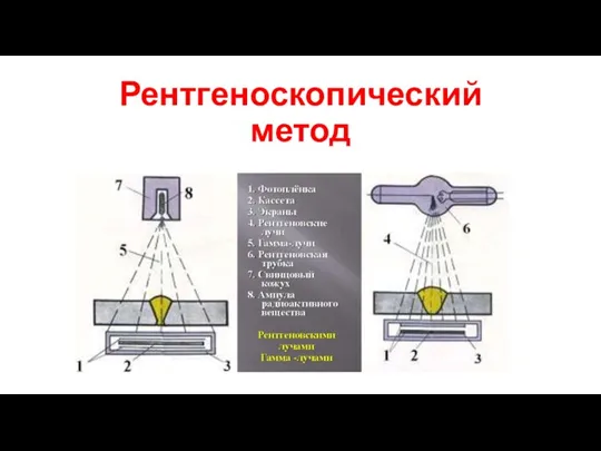 Рентгеноскопический метод