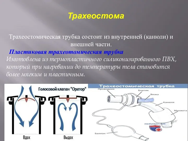 Трахеостомическая трубка состоит из внутренней (канюли) и внешней части. Изготовлена