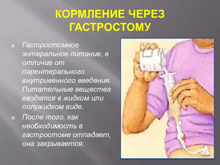 КОРМЛЕНИЕ ЧЕРЕЗ ГАСТРОСТОМУ Гастростомное энтеральное питание, в отличие от парентерального