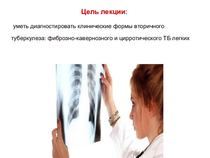 Цель лекции: уметь диагностировать клинические формы вторичного туберкулеза: фиброзно-кавернозного и цирротического ТБ легких