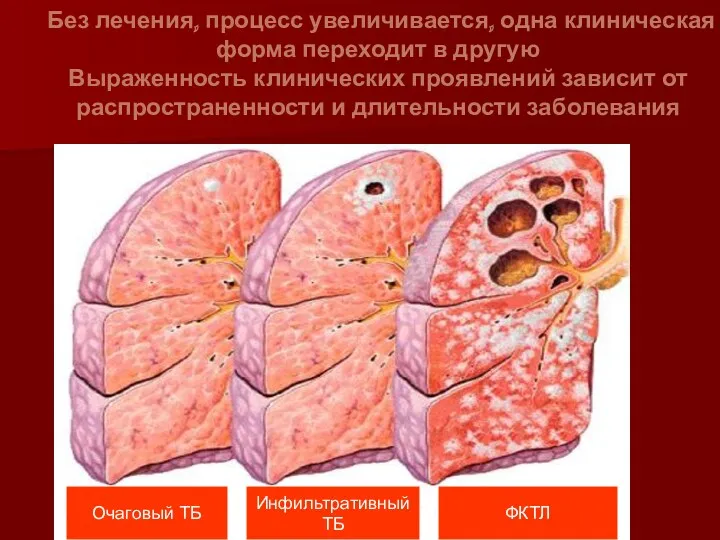 Без лечения, процесс увеличивается, одна клиническая форма переходит в другую